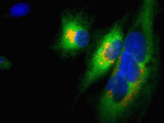 CellLight®-transduced HeLa cells in Nunc™ glass-bottom microwell plates imaged on EVOS® FL Auto at 60X